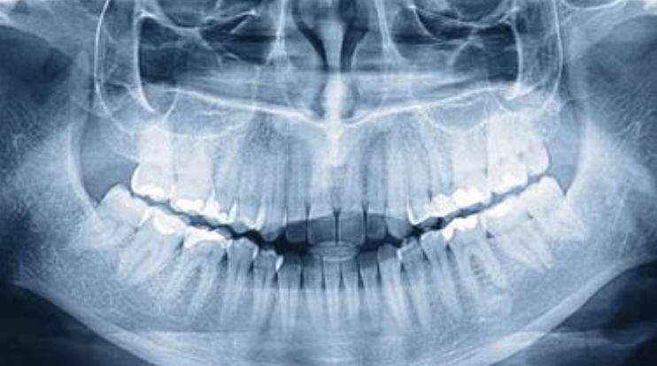 Kes teadis, et inimestel on kolmas hammaste komplekt