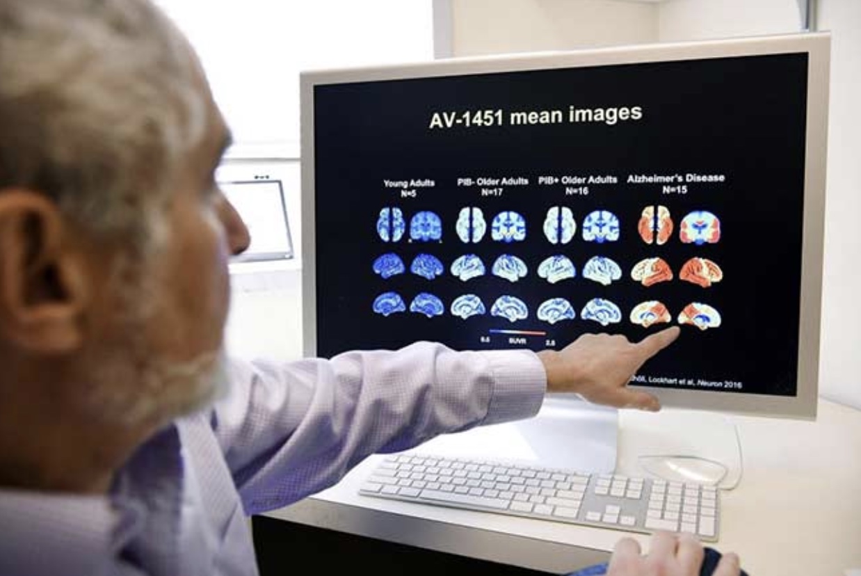 Diabeedi ja Alzheimeri tagasipööramine